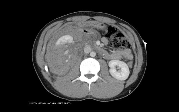 Genitourinary Trauma