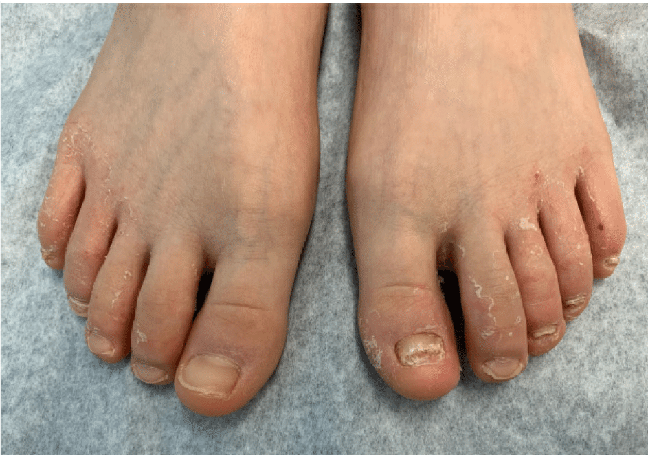 Dermatology Pearls for Primary Care - Module 3