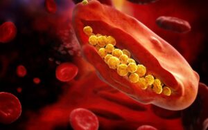 Parasites, Puzzles and Poetry: Deciphering Severe Malaria