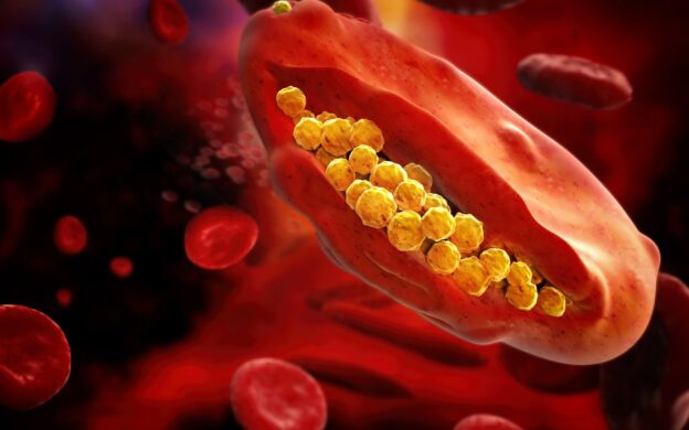 Parasites, Puzzles and Poetry: Deciphering Severe Malaria