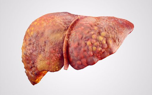 Viral Hepatitis
